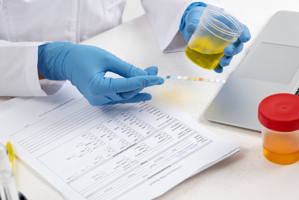 Urine Testing