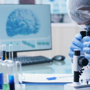 PSA (PROSTATE SPECIFIC ANTIGEN) TOTAL